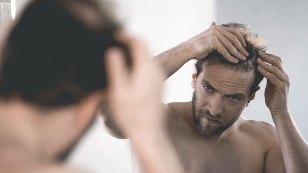 Dit moet je weten over een haartransplatatie