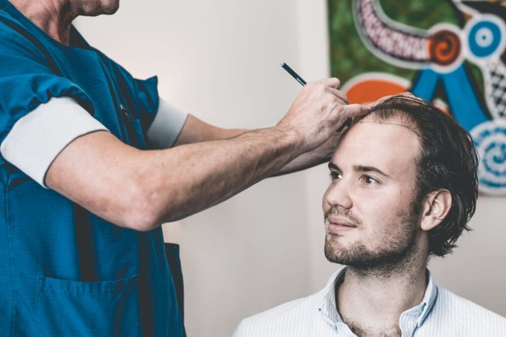 Ik onderging een haartransplantatie. Dit komt er bij kijken!