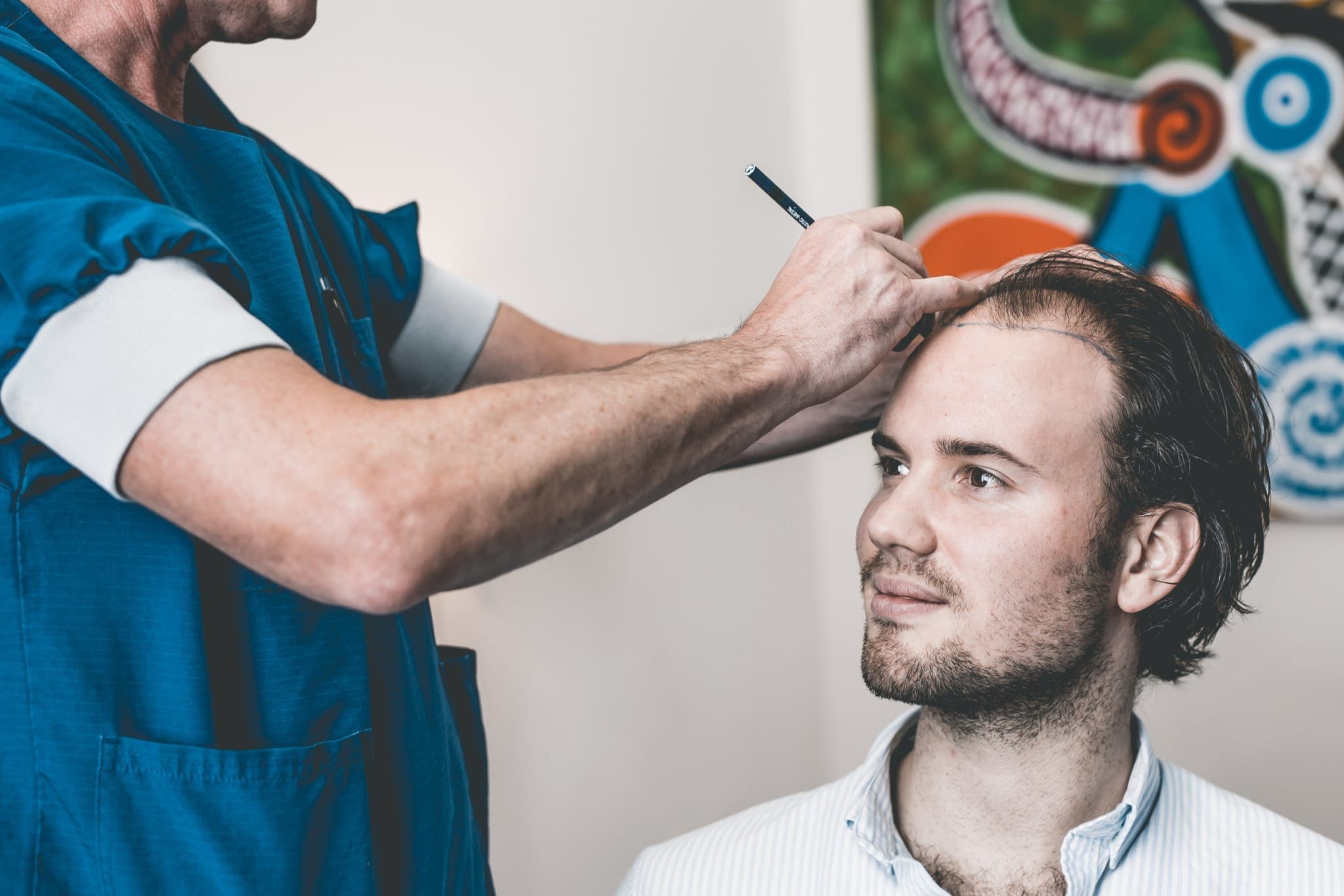 Ik onderging een haartransplantatie. Dit komt er bij kijken!